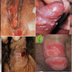 Illustration for article titled Penis saya keluar nanah dan kencing terasa panas terbakar